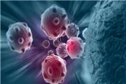 روشی نوین برای نابودی سلول‌های سرطانی با کمک نانوذرات