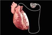 استفاده از الکتریسیته برای ترمیم قلب