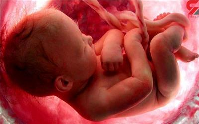 طرح جدید مجلس برای سقط جنینی که مشکل جسمی یا ژنتیک دارد