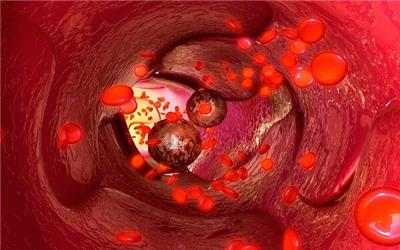 در پژوهشگاه رویان؛ عوامل تومورزایی سرطان پانکراس در مردان شناسایی شد