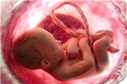 محققان پی بردند؛ قرارگیری مادر باردار در معرض آلودگی هوا به رشد جنین آسیب می رساند